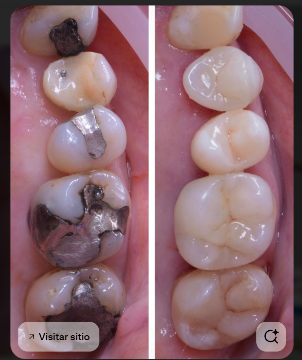 Odontología General y Cirugía de tercero molares